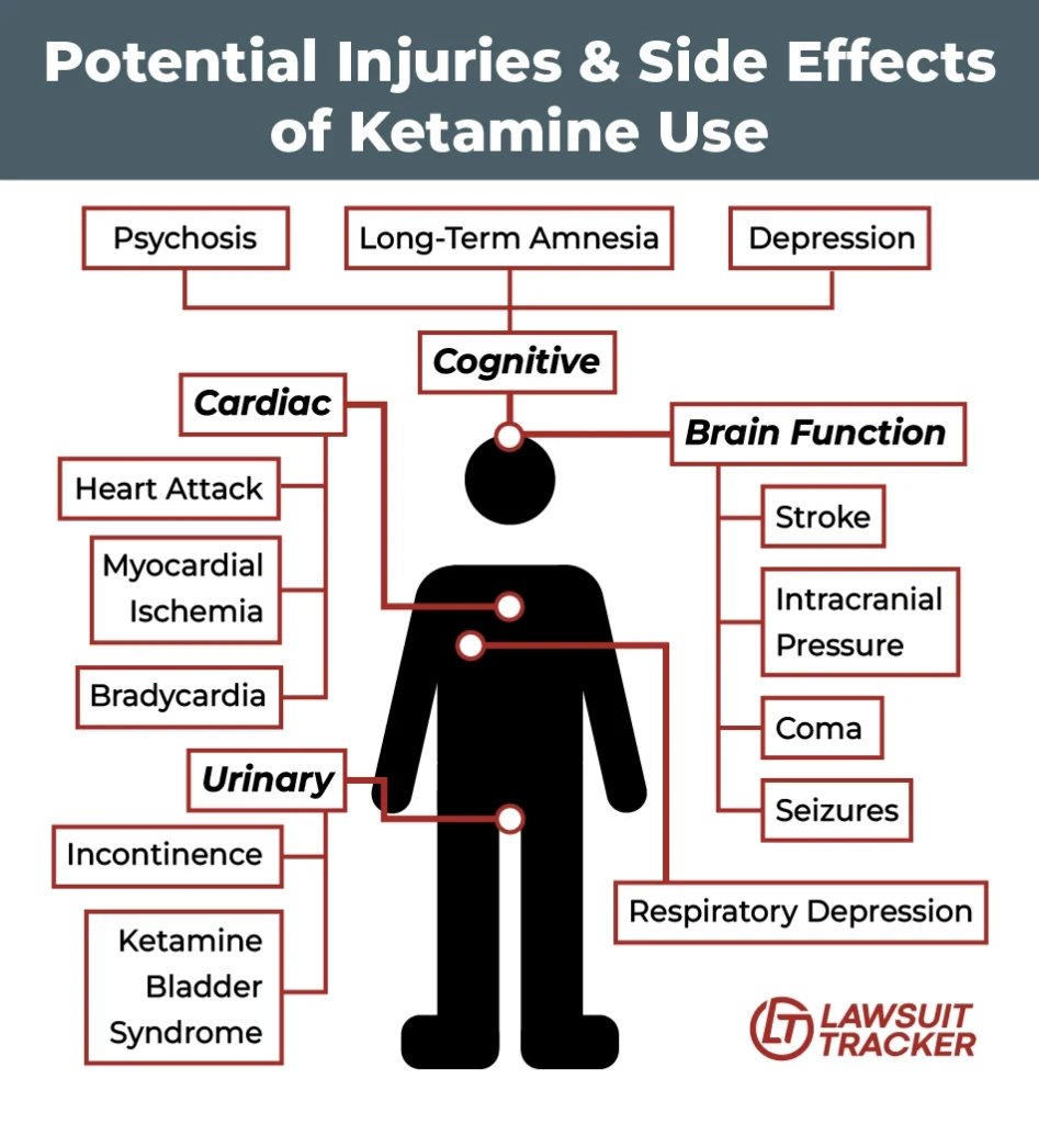 Graphic showing the potential injuries and side effects of ketamine use on different parts of the body.
